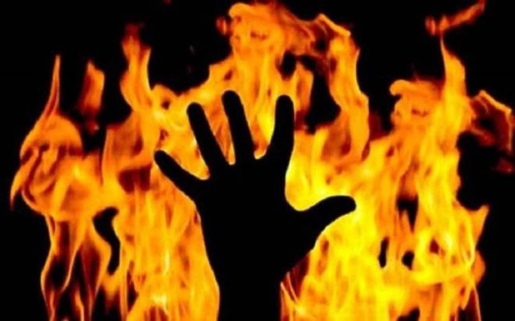 15 year old Muslim boy set ablaze in UP