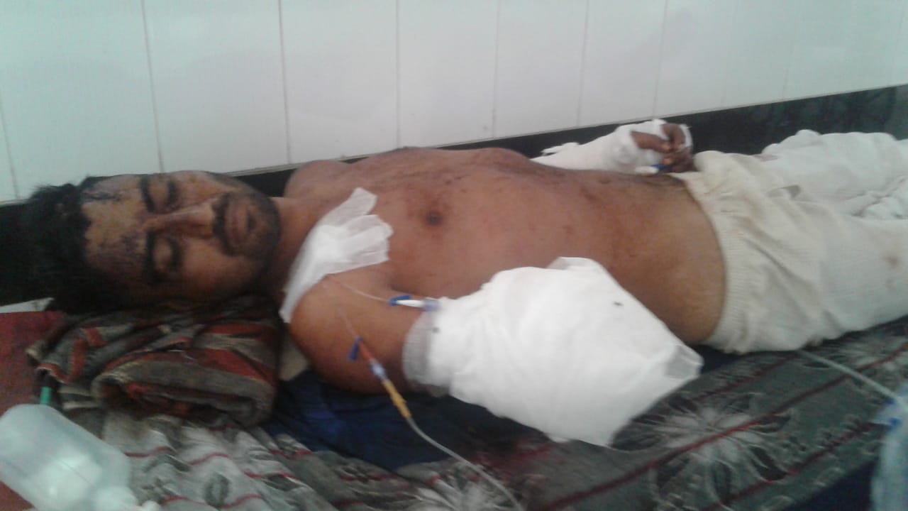 “My brother’s wounds are screaming of monstrosity of attack,” family of lynching survivor Akhlaq Salmani losing hope for justice